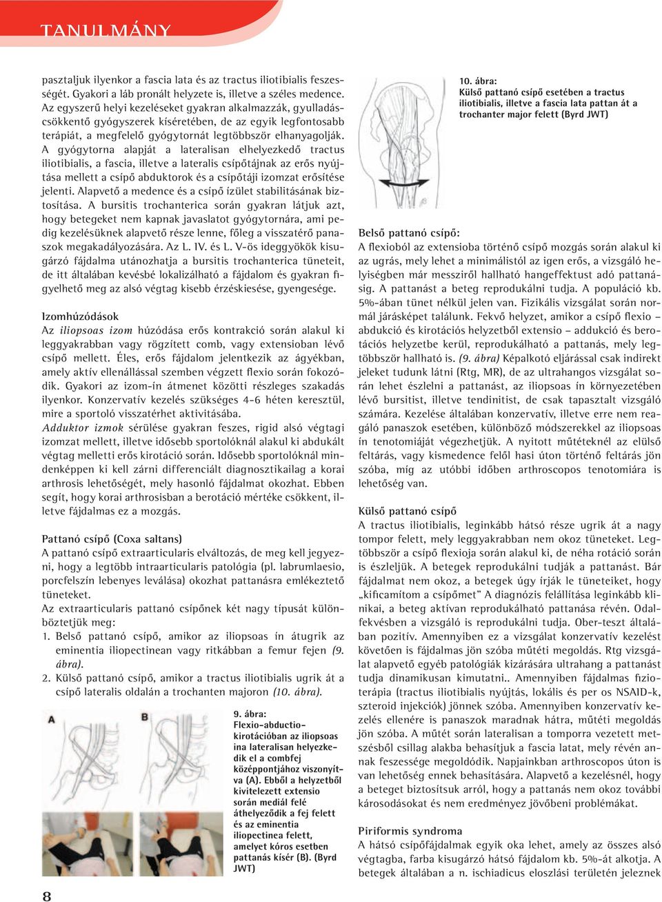 A gyógytorna alapját a lateralisan elhelyezkedô tractus iliotibialis, a fascia, illetve a lateralis csípôtájnak az erôs nyújtása mellett a csípô abduktorok és a csípôtáji izomzat erôsítése jelenti.