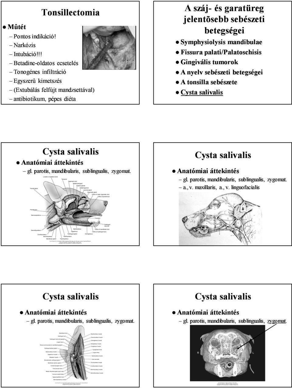 sebészeti betegségei Symphysiolysis mandibulae Fissura palati/palatoschisis Gingivális tumorok A tonsilla sebészete Anatómiai áttekintés gl.