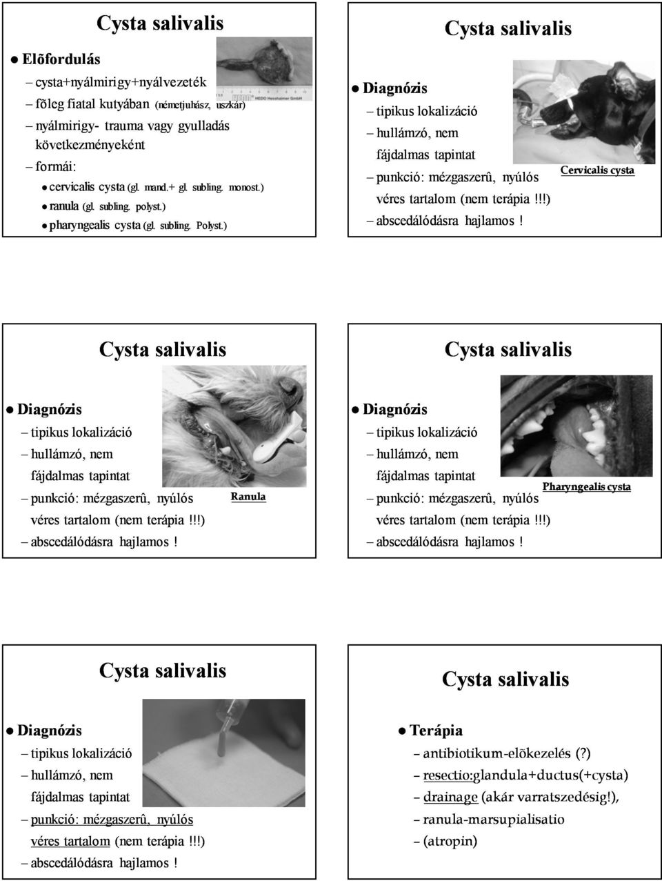 !!) abscedálódásra hajlamos! Cervicalis cysta Diagnózis tipikus lokalizáció hullámzó, nem fájdalmas tapintat punkció: mézgaszerû, nyúlós véres tartalom (nem terápia!!!) abscedálódásra hajlamos! Ranula Diagnózis tipikus lokalizáció hullámzó, nem fájdalmas tapintat punkció: mézgaszerû, nyúlós véres tartalom (nem terápia!