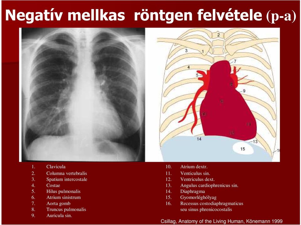 Atrium dextr. 11. Venticulus sin. 12. Ventriculus dext. 13. Angulus cardiophrenicus sin. 14. Diaphragma 15.