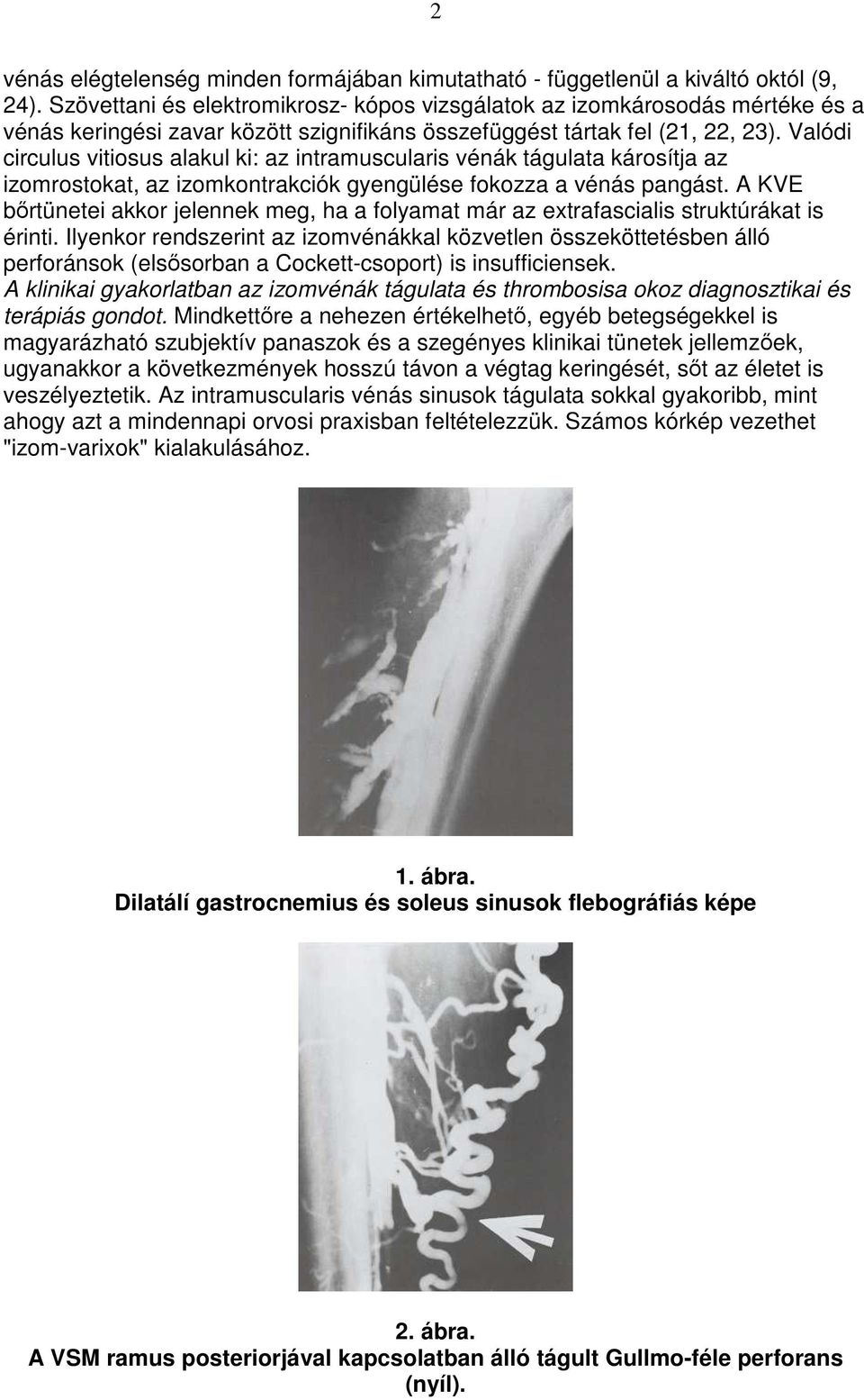 Valódi circulus vitiosus alakul ki: az intramuscularis vénák tágulata károsítja az izomrostokat, az izomkontrakciók gyengülése fokozza a vénás pangást.