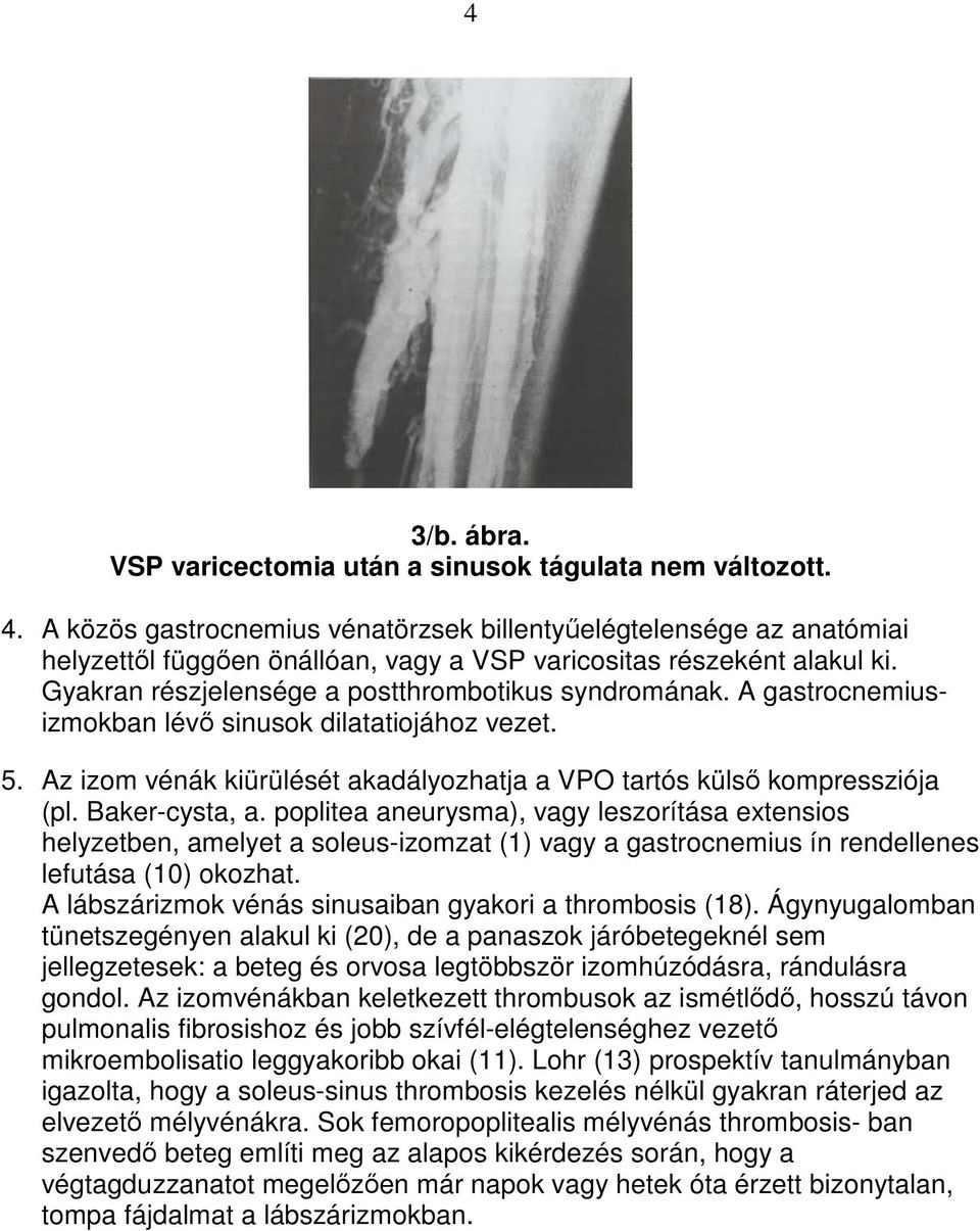 A gastrocnemiusizmokban lévı sinusok dilatatiojához vezet. 5. Az izom vénák kiürülését akadályozhatja a VPO tartós külsı kompressziója (pl. Baker-cysta, a.