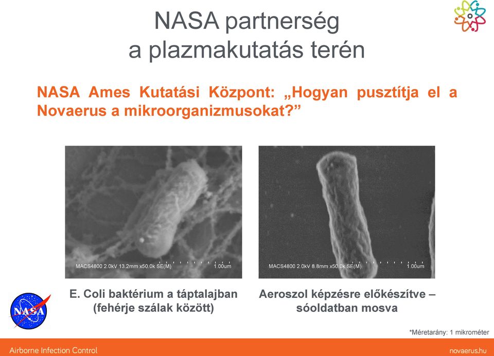 E. Coli baktérium a táptalajban (fehérje szálak között)