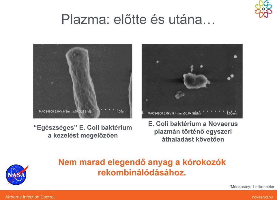 Coli baktérium a Novaerus plazmán történő egyszeri