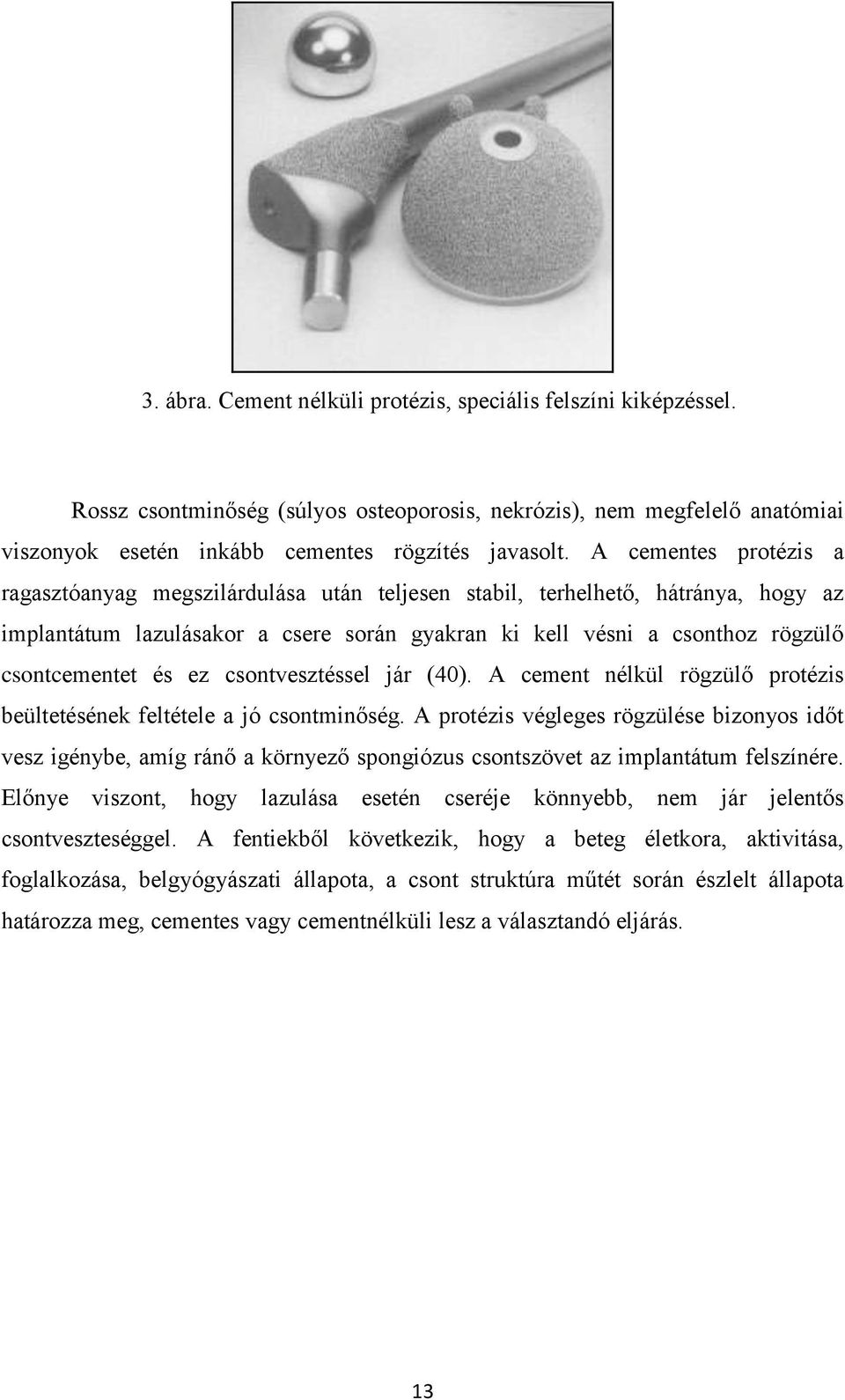 ez csontvesztéssel jár (40). A cement nélkül rögzülő protézis beültetésének feltétele a jó csontminőség.