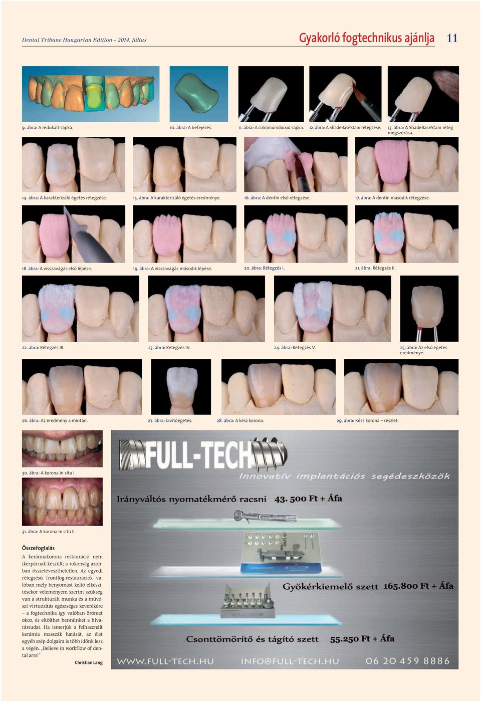 ábra: A dentin első rétegzése. 17. ábra: A dentin második rétegzése. 18. ábra: A visszavágás első lépése. 19. ábra: A visszavágás második lépése. 20. ábra: Rétegzés I. 21. ábra: Rétegzés II. 22.