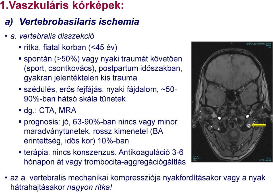 jelentéktelen kis trauma szédülés, erős fejfájás, nyaki fájdalom, ~50-90%-ban hátsó skála tünetek dg.