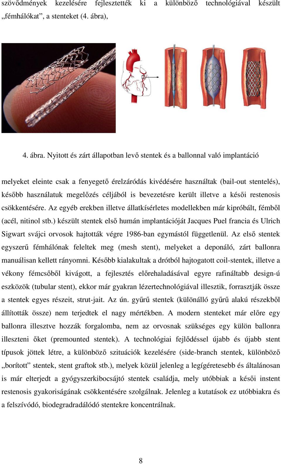 Nyitott és zárt állapotban levı stentek és a ballonnal való implantáció melyeket eleinte csak a fenyegetı érelzáródás kivédésére használtak (bail-out stentelés), késıbb használatuk megelızés céljából