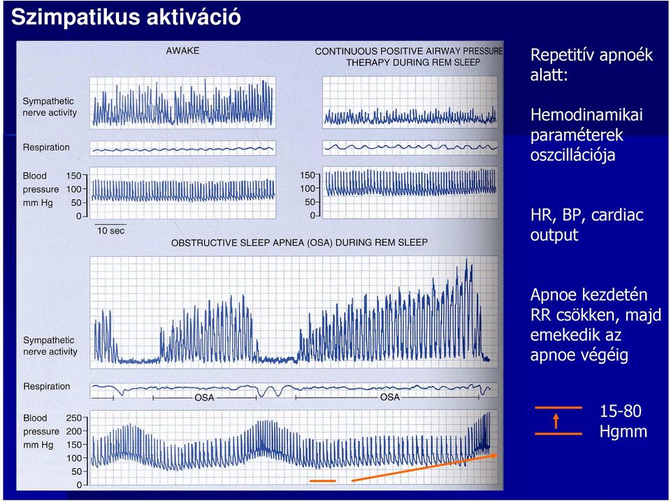 oszcillációja HR, BP, cardiac output Apnoe