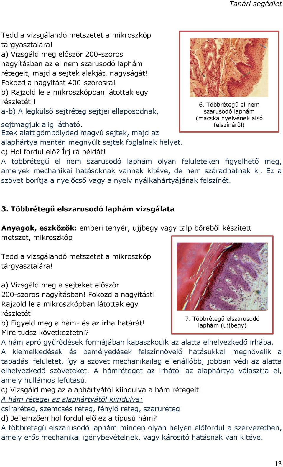 Ezek alatt gömbölyded magvú sejtek, majd az alaphártya mentén megnyúlt sejtek foglalnak helyet. c) Hol fordul elő? Írj rá példát! 6.