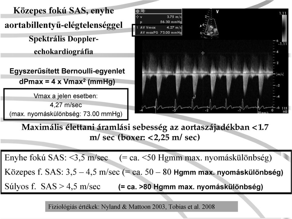 7 m/sec (boxer: <2,25 m/sec) Enyhe fokú SAS: <3,5 m/sec (= ca. <50 Hgmm max. nyomáskülönbség) Közepes f. SAS: 3,5 4,5 m/sec (= ca.