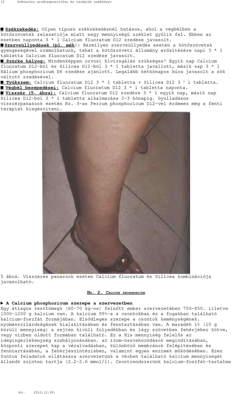 méh): Bármilyen szervsüllyedés esetén a kötőszövetek gyengeségével számolhatunk, tehát a kötőszöveti állomány erősítésére napi 3 * 1 tabletta Calcium fluoratum D12 szedése javasolt.