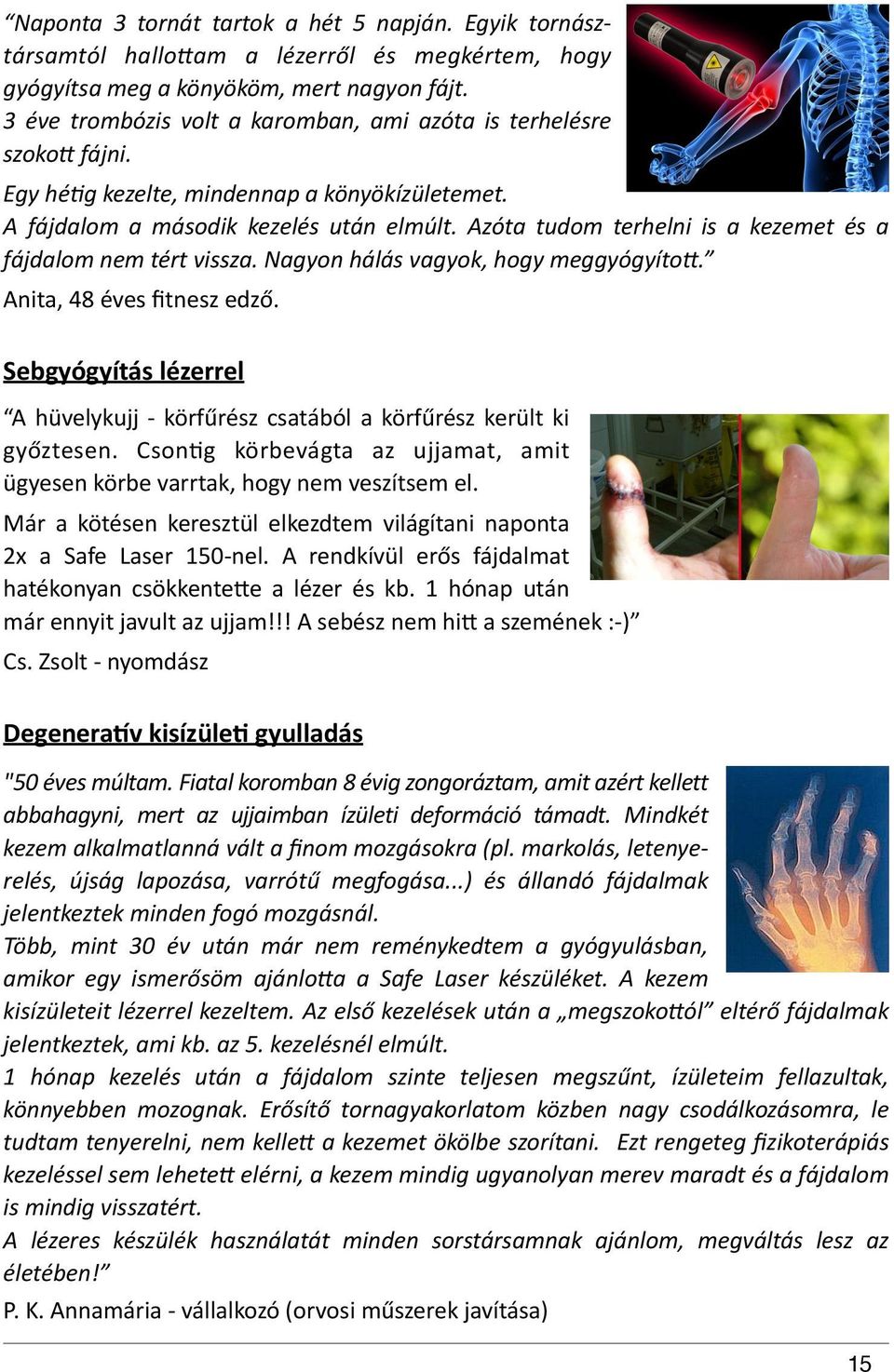 " Azóta" tudom" terhelni" is" a" kezemet" és" a" fájdalom"nem"tért"vissza."nagyon"hálás"vagyok,"hogy"meggyógyítoi. " Anita,"48"éves"ﬁtnesz"edző.