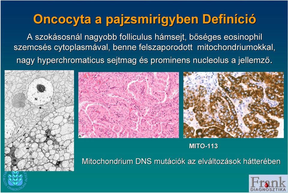 mitochondriumokkal, nagy hyperchromaticus sejtmag és s prominens nucleolus a