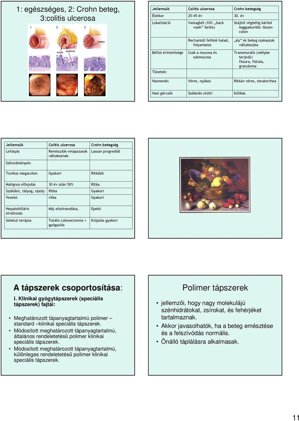 terjedő) fissura, fistula, granuloma Hasmenés Véres, nyákos Ritkán véres, steatorrhea Hasi görcsök Székelés előtti Kólikás Jellemzők Lefolyás Szövődmények: Toxikus megacolon Colitis ulcerosa