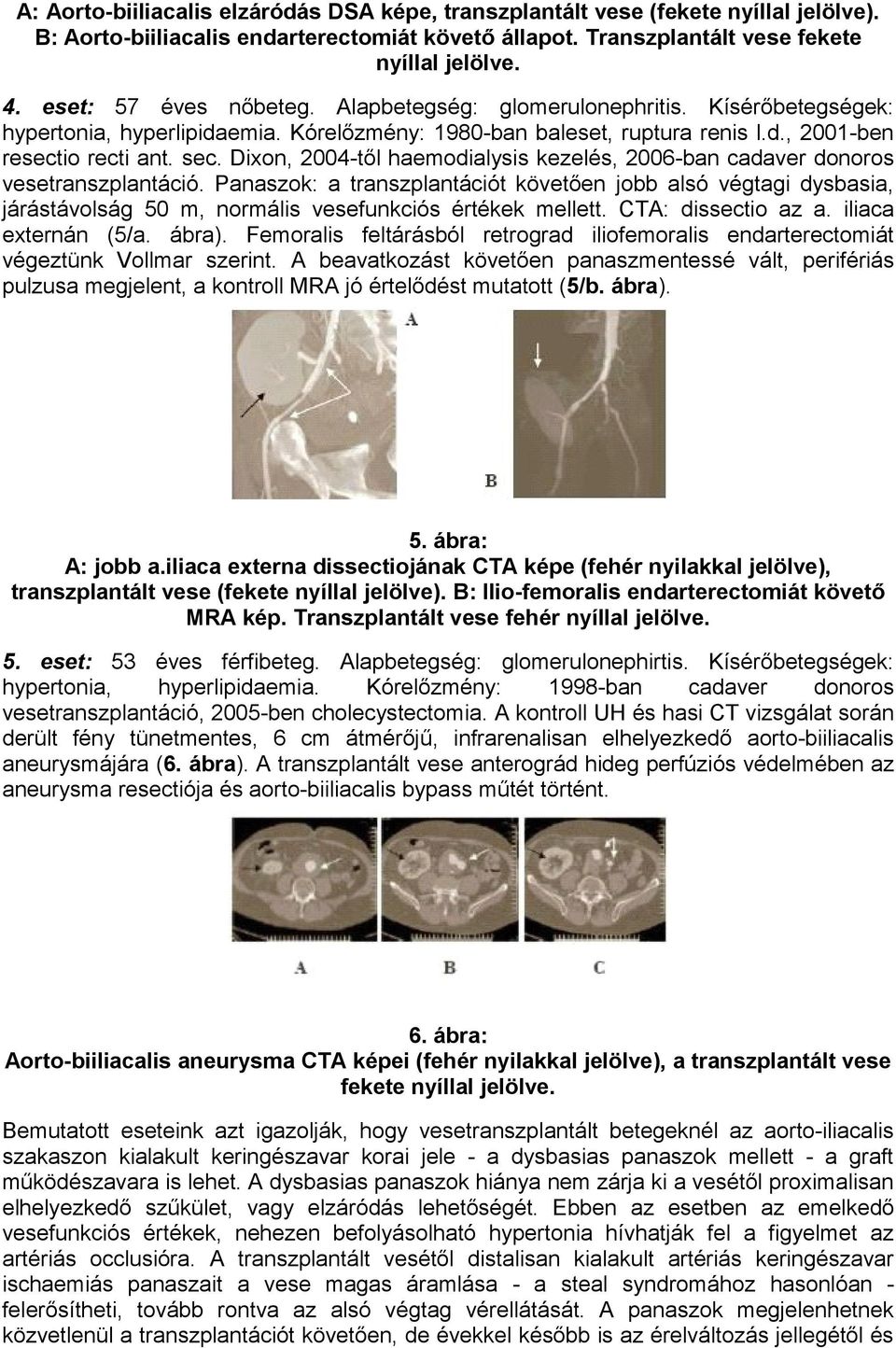 Dixon, 2004-től haemodialysis kezelés, 2006-ban cadaver donoros vesetranszplantáció.