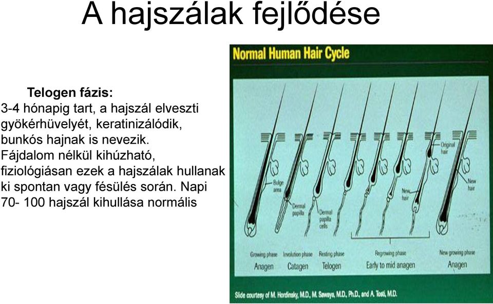 Fájdalom nélkül kihúzható, fiziológiásan ezek a hajszálak hullanak