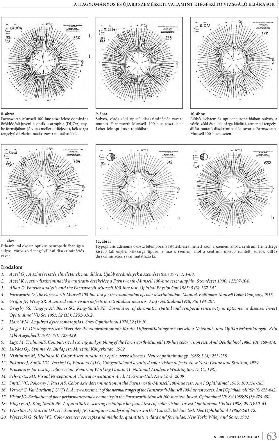 ki. 9. ábra: Súlyos, vörös-zöld típusú diszkriminációs zavart mutató Farnsworth-Munsell 100-hue teszt lelet Leber-féle optikus atrophiában 10.