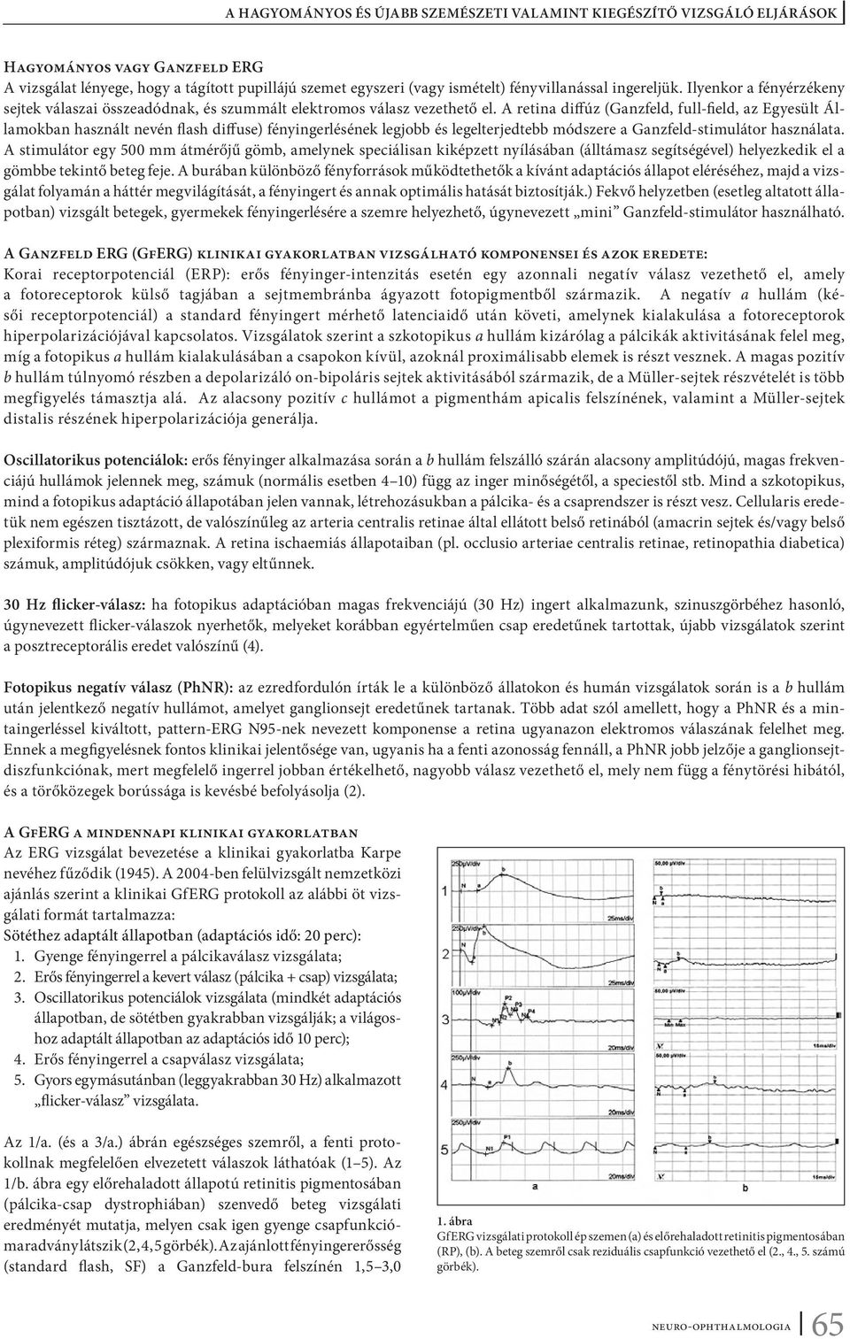 A retina diffúz (Ganzfeld, full-field, az Egyesült Államokban használt nevén flash diffuse) fényingerlésének legjobb és legelterjedtebb módszere a Ganzfeld-stimulátor használata.