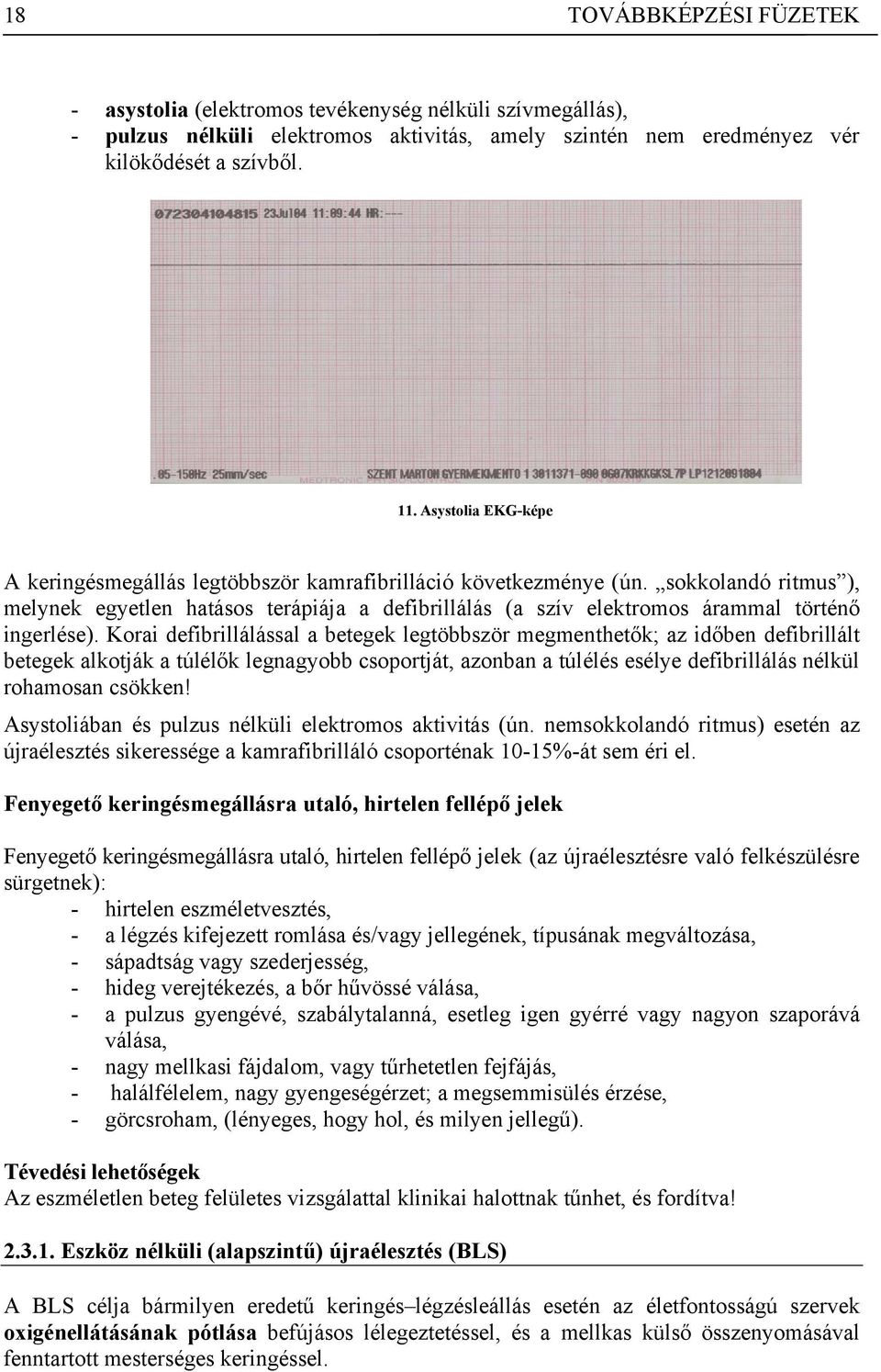 sokkolandó ritmus ), melynek egyetlen hatásos terápiája a defibrillálás (a szív elektromos árammal történő ingerlése).