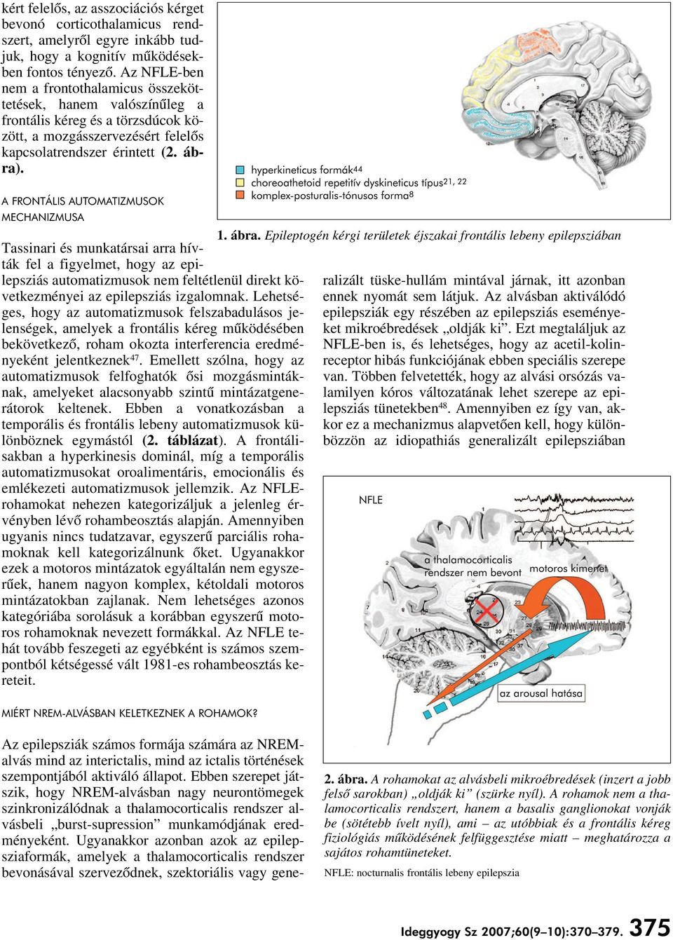 A FRONTÁLIS AUTOMATIZMUSOK MECHANIZMUSA Tassinari és munkatársai arra hívták fel a figyelmet, hogy az epilepsziás automatizmusok nem feltétlenül direkt következményei az epilepsziás izgalomnak.