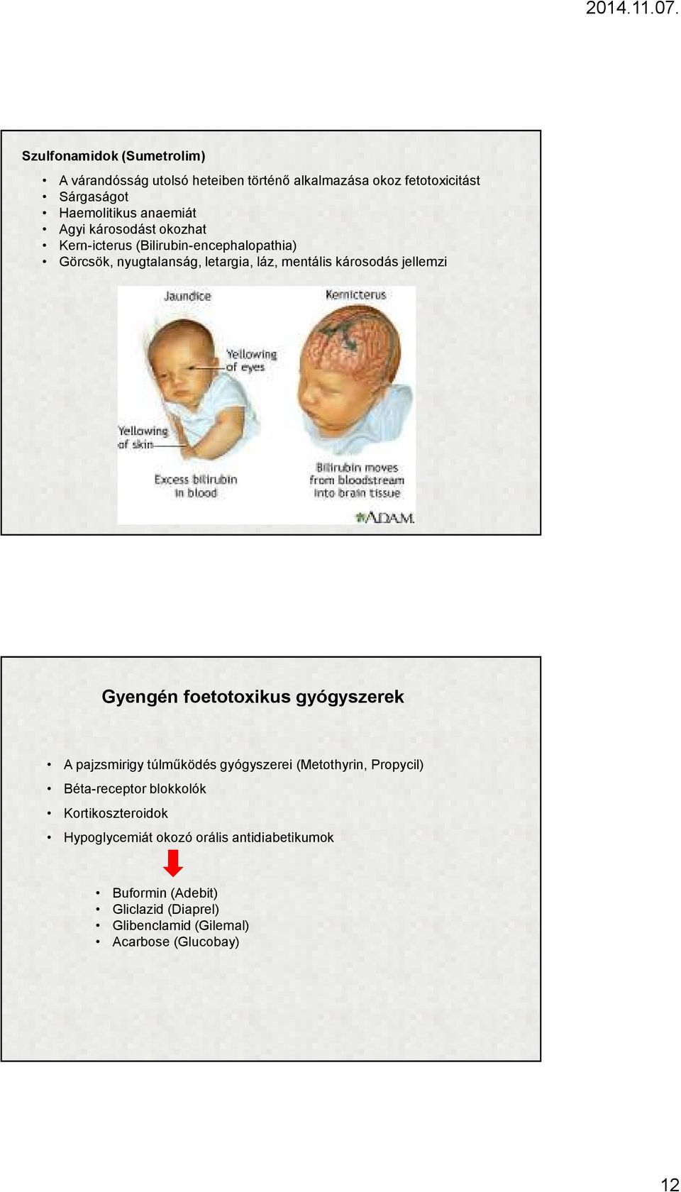 Gyengén foetotoxikus gyógyszerek A pajzsmirigy túlműködés gyógyszerei (Metothyrin, Propycil) Béta-receptor blokkolók