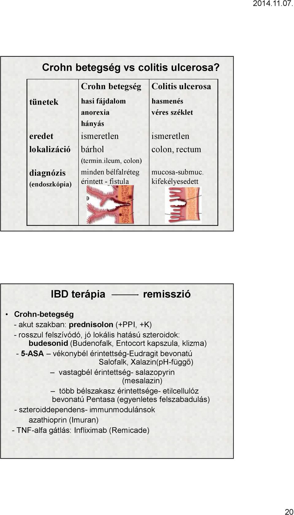 ileum, colon) minden bélfalréteg érintett - fistula colon, rectum mucosa-submuc.