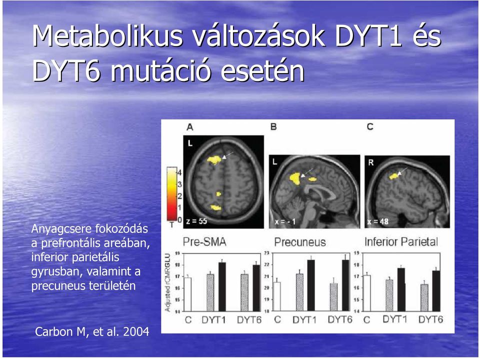 prefrontális areában, inferior parietális