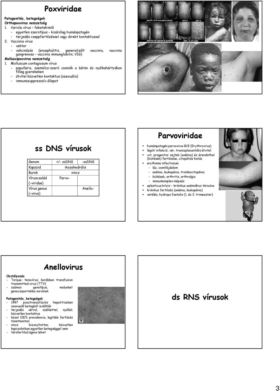 Molluscum contagiosum vírus - papullaris, szemölcs-szerű csomók a bőrön és nyálkahártyákon főleg gyerekeken - átvitel közvetlen kontaktus (szexuális) - immunszuppresszív állapot Parvoviridae ss DNS