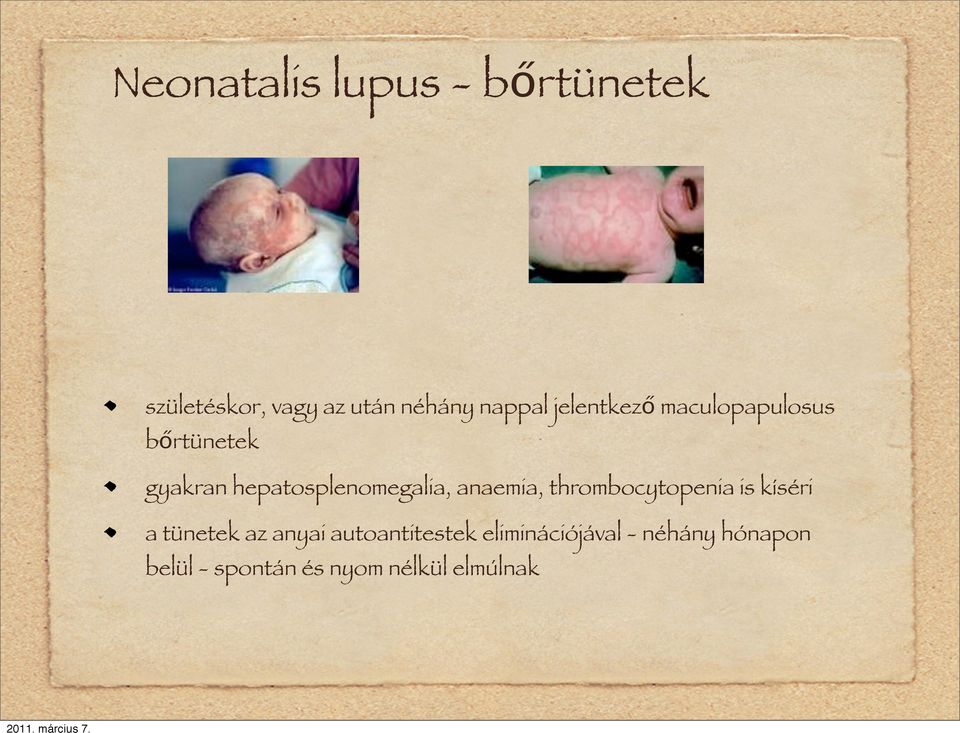 anaemia, thrombocytopenia is kíséri a tünetek az anyai autoantitestek