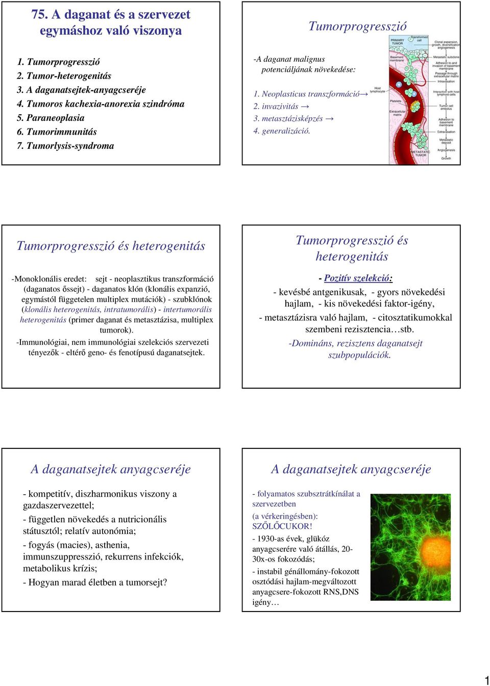 Tumorprogresszió és heterogenitás -Monoklonális eredet: sejt - neoplasztikus transzformáció (daganatos ıssejt) - daganatos klón (klonális expanzió, egymástól függetelen multiplex mutációk) -