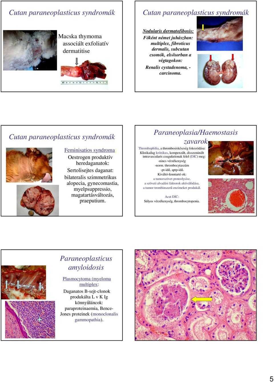 Cutan paraneoplasticus syndromák Feminisatios syndroma: Oestrogen produktív heredaganatok: Sertolisejtes daganat: bilateralis szimmetrikus alopecia, gynecomastia, myelpsuppressio, magatartásváltozás,