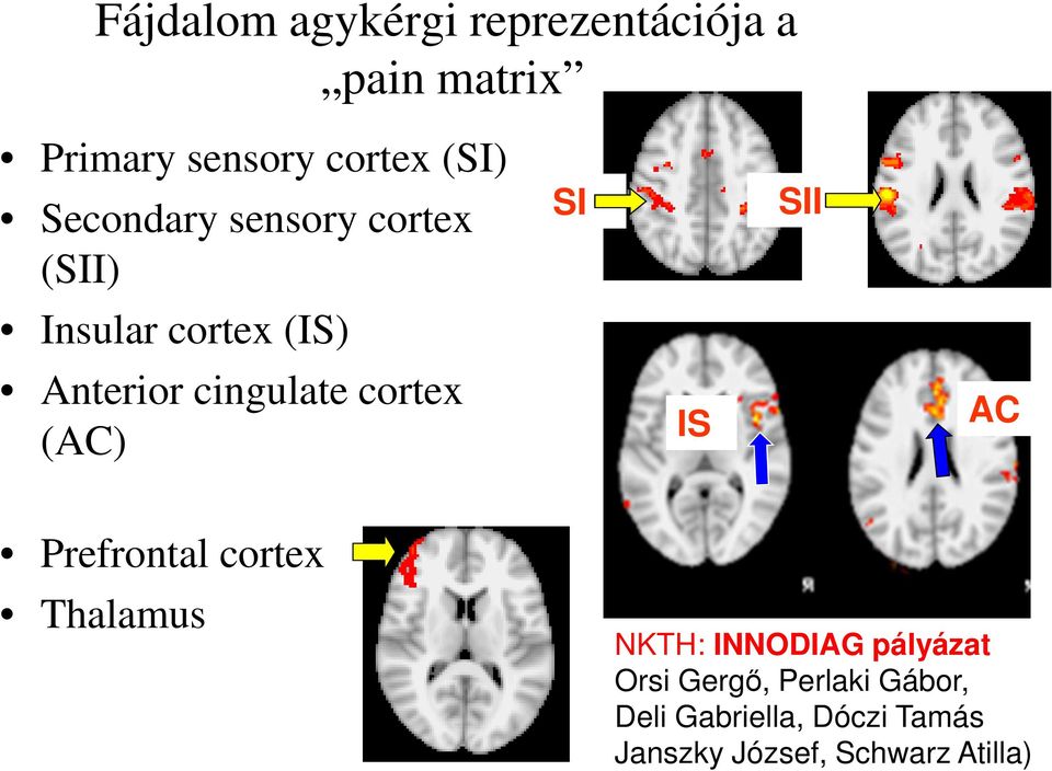 (AC) SI IS iisii AC Prefrontal cortex Thalamus NKTH: INNODIAG pályázat Orsi