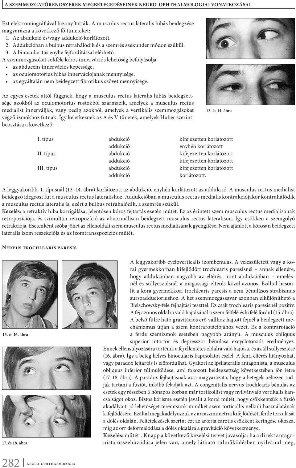 A szemmozgásokat sokféle kóros innervációs lehetőség befolyásolja: az abducens innervációs képessége, az oculomotorius hibás innervációjának mennyisége, az egyáltalán nem beidegzett fibrotikus szövet