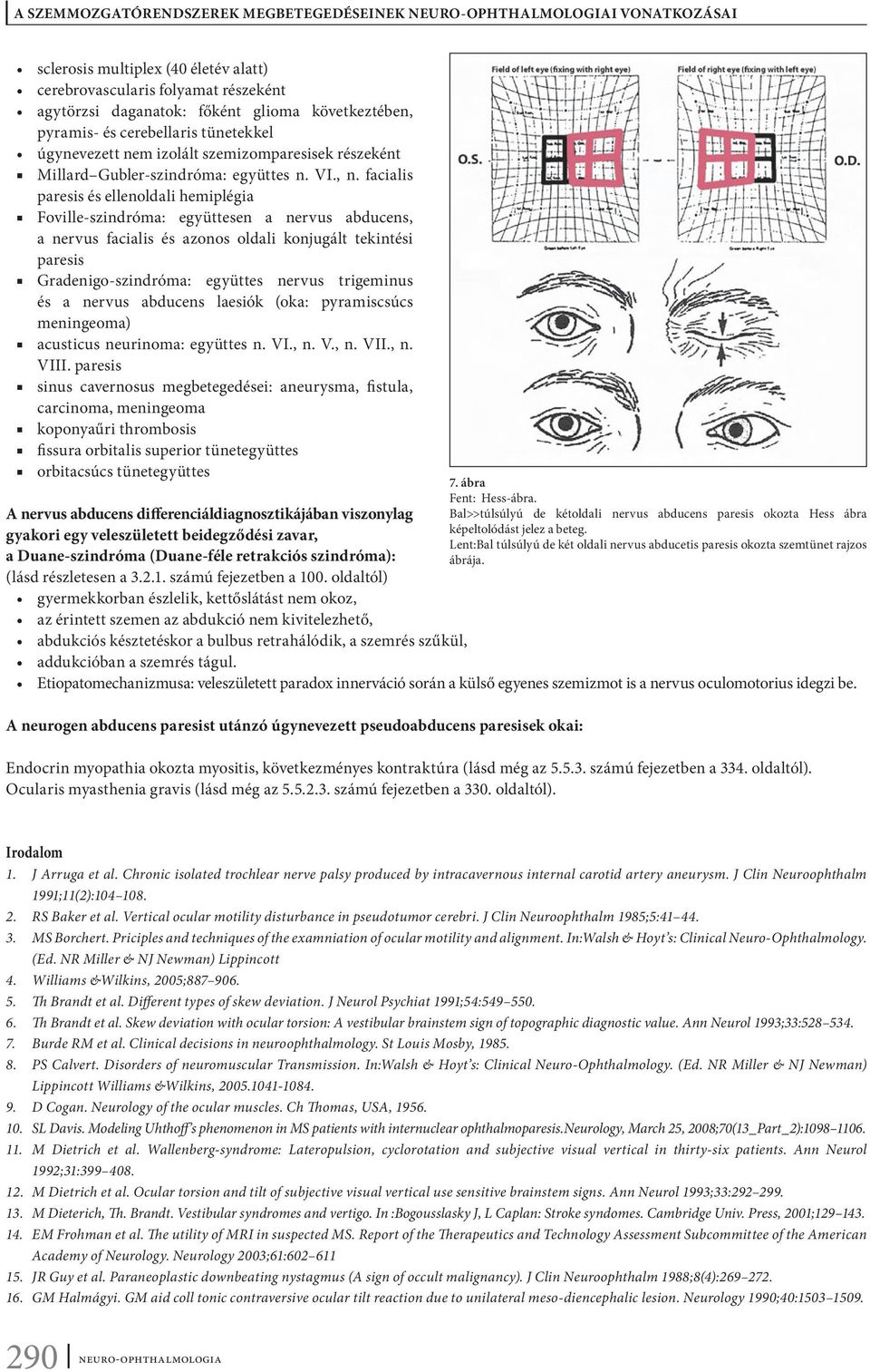 facialis paresis és ellenoldali hemiplégia Foville-szindróma: együttesen a nervus abducens, a nervus facialis és azonos oldali konjugált tekintési paresis Gradenigo-szindróma: együttes nervus