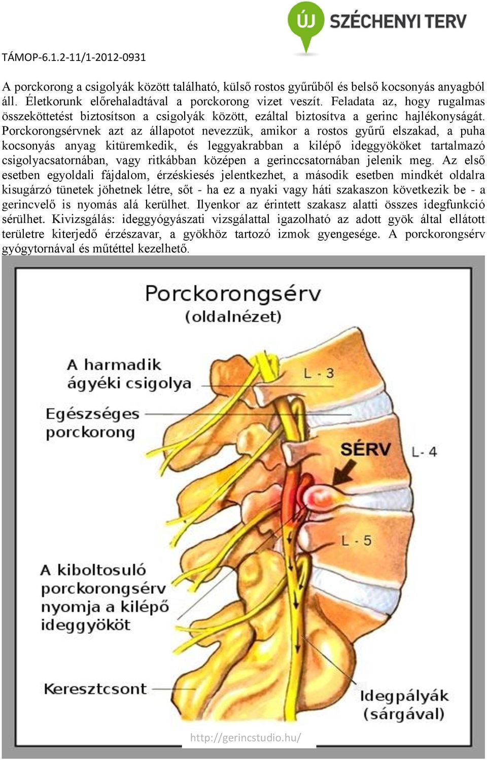 Porckorongsérvnek azt az állapotot nevezzük, amikor a rostos gyűrű elszakad, a puha kocsonyás anyag kitüremkedik, és leggyakrabban a kilépő ideggyököket tartalmazó csigolyacsatornában, vagy ritkábban