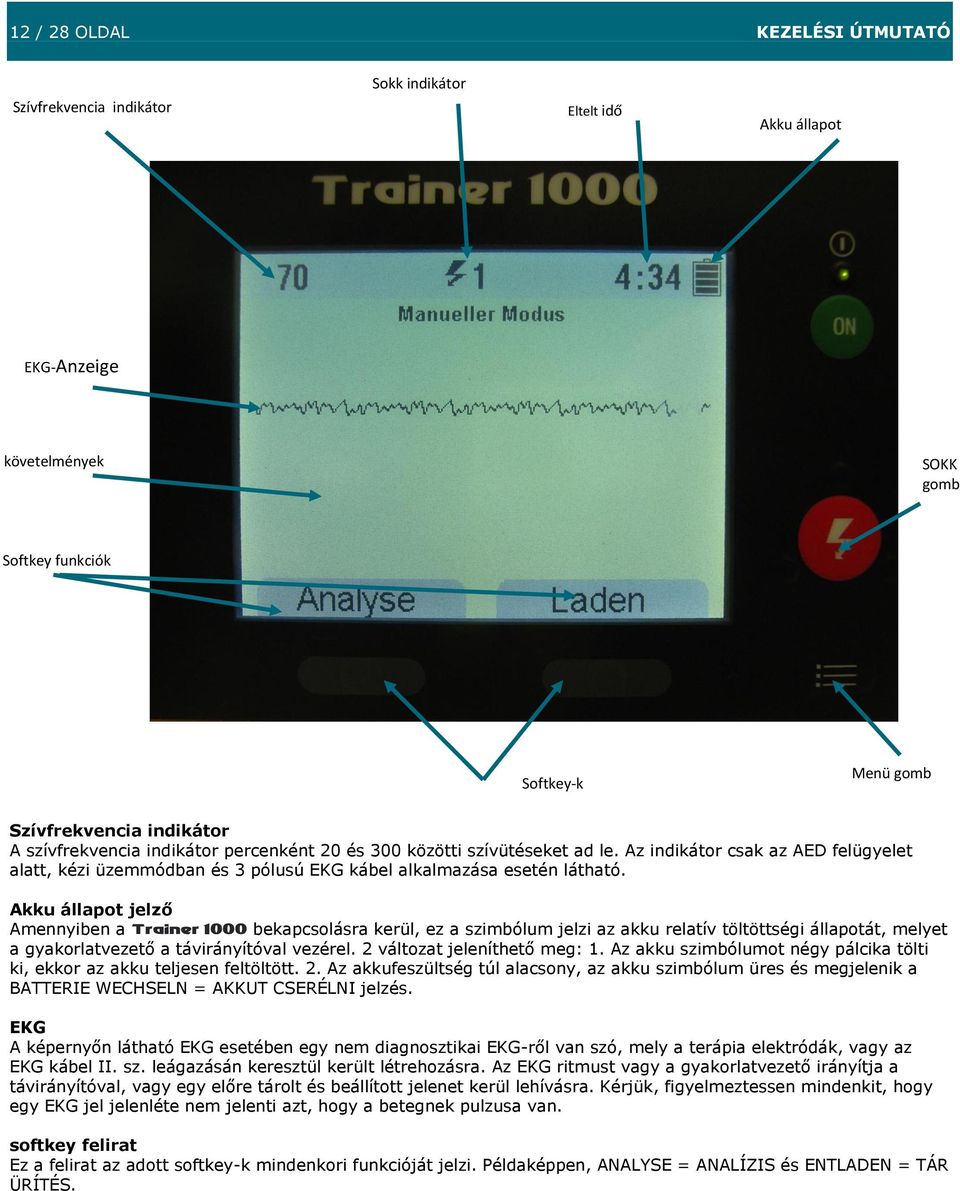 Az indikátor csak az AED felügyelet alatt, kézi üzemmódban és 3 pólusú EKG kábel alkalmazása esetén látható.
