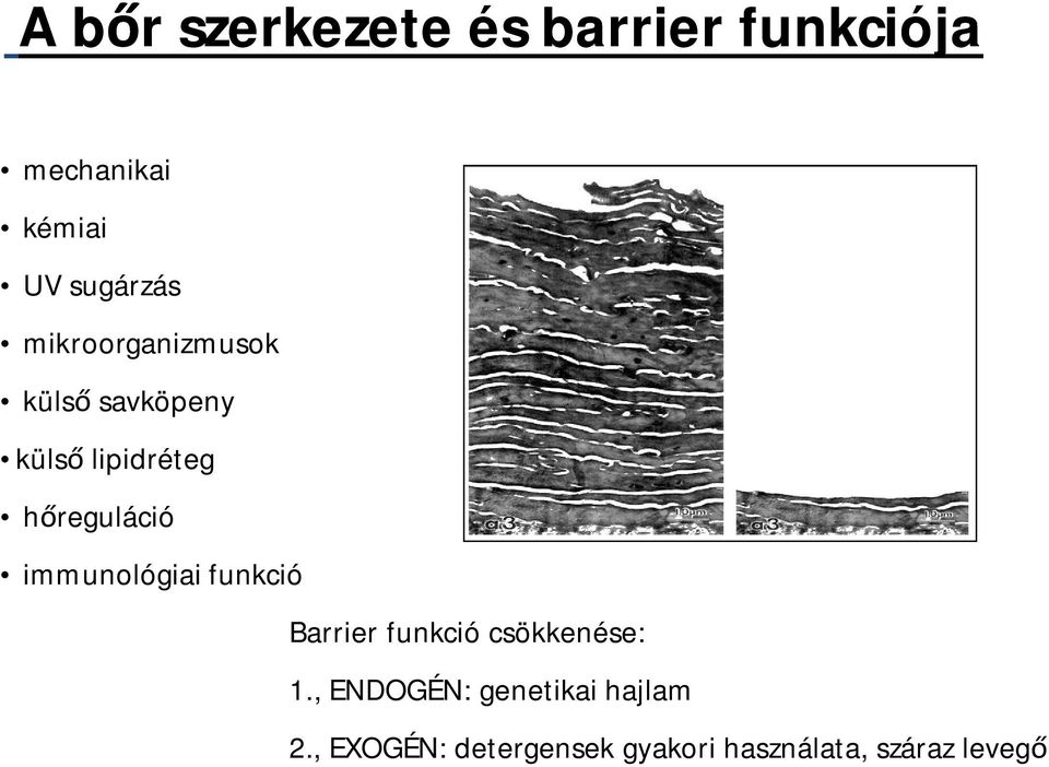 reguláció immunológiai funkció Barrier funkció csökkenése: 1.