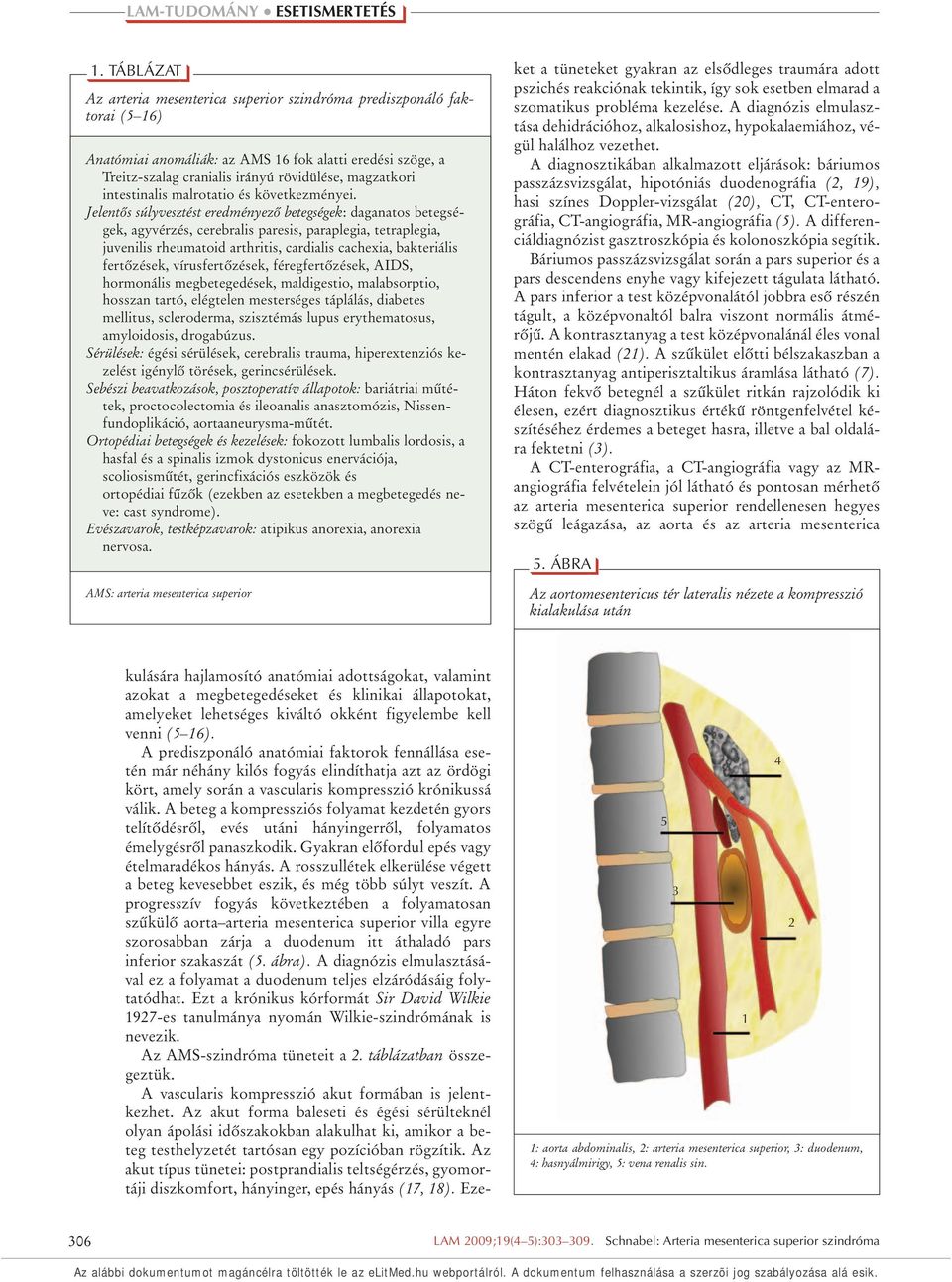 Jelentôs súlyvesztést eredményezô betegségek: daganatos betegségek, agyvérzés, cerebralis paresis, paraplegia, tetraplegia, juvenilis rheumatoid arthritis, cardialis cachexia, bakteriális fertôzések,