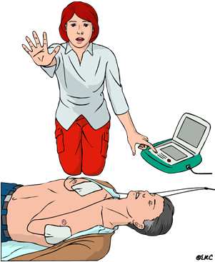 AED használata DEFIBRILLÁLÁS Fibrilláció-defibrilláció Fibrilláció: a szívizomrostok olyan kóros remegése, amely nincs összhangban a szívizomzat