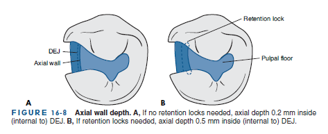 Az üreg kezdeti mélységének meghatározása Axialis fal mélységének meghatározása 0,2mm mélyen a dentinben 0,5mm mélyen a dentinben másodlagos retenciós elemek használata esetén (A másodlagos