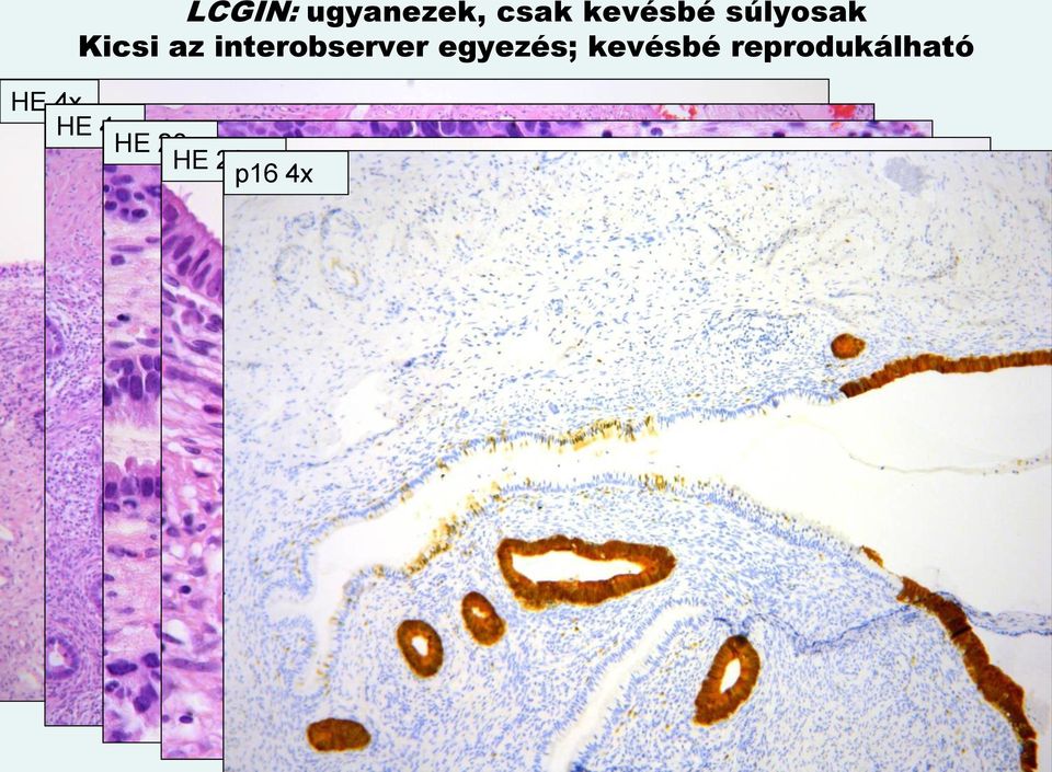 egyezés; kevésbé reprodukálható