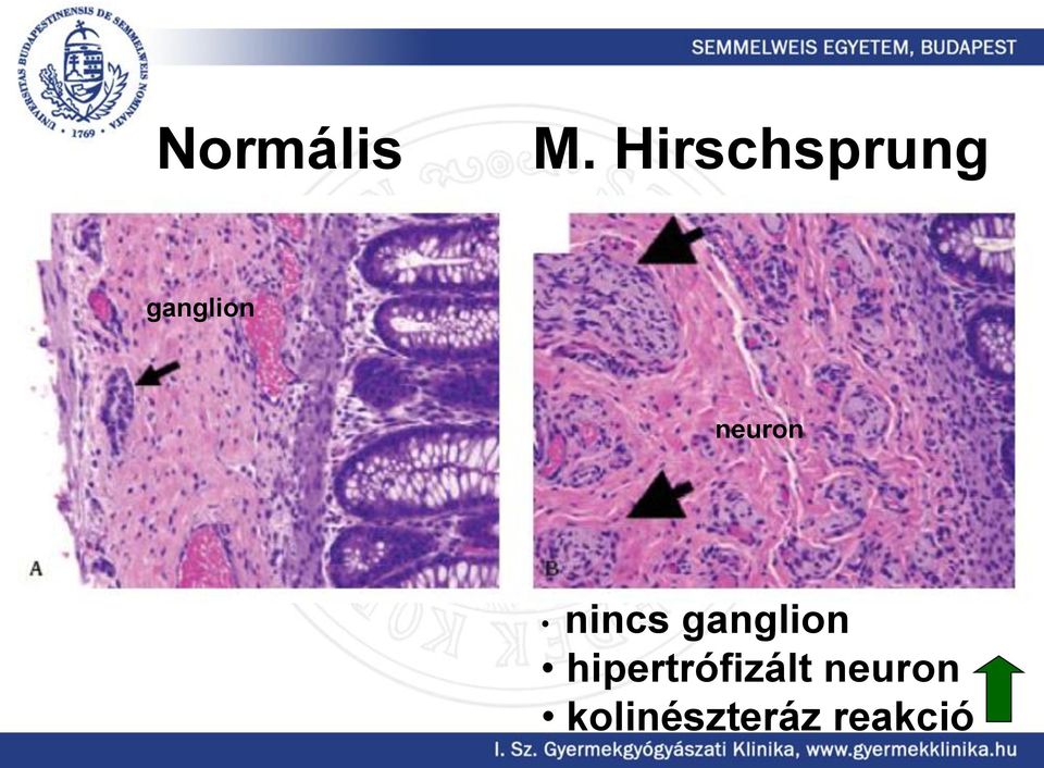 neuron nincs ganglion