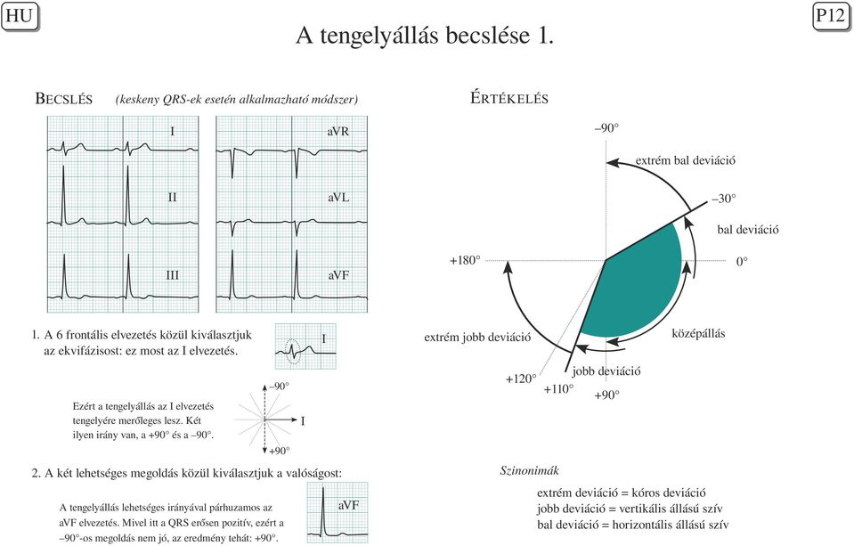 középállás extrém jobb deviáció I jobb deviáció 110 90 I 90 2. A két lehetséges megoldás közül kiválasztjuk a valóságost: A tengelyállás lehetséges irányával párhuzamos az avf elvezetés.