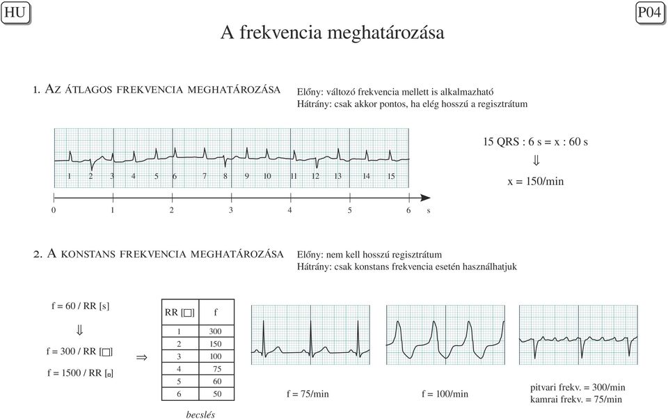 MEGHATÁROZÁSA 15 QRS : 6 s = x : 60 s 1 2 0 2.