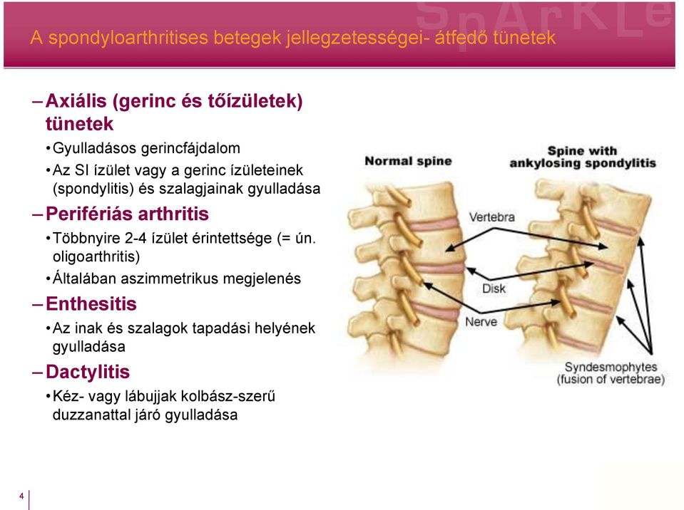 arthritis Többnyire 2-4 ízület érintettsége (= ún.