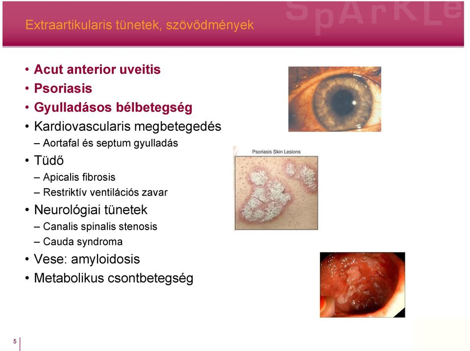 gyulladás Tüdő Apicalis fibrosis Restriktív ventilációs zavar Neurológiai