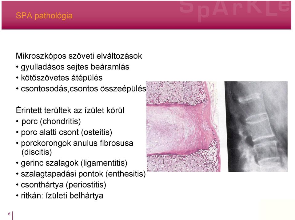 porc alatti csont (osteitis) porckorongok anulus fibrosusa (discitis) gerinc szalagok