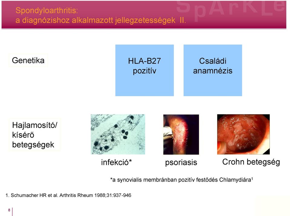 betegségek infekció* psoriasis Crohn betegség *a synovialis membránban