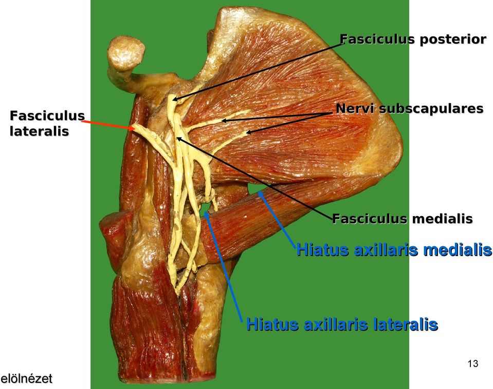 Fasciculus medialis Hiatus axillaris